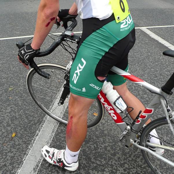 Kane shows some road rash.